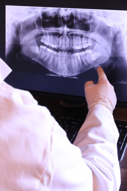 Best Emergency Treatment for Dental Infections or Abscesses in Slinger, WI