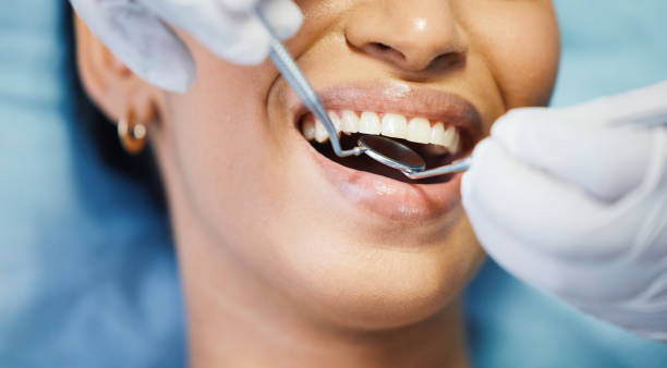 Best Emergency Tooth Extraction in Slinger, WI